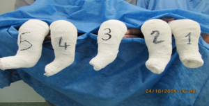 Series of casts.